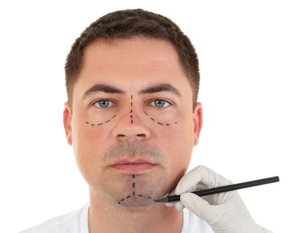 Il concetto di chirurgia plastica. Mano nel guanto marcatura volto maschile — Foto Stock