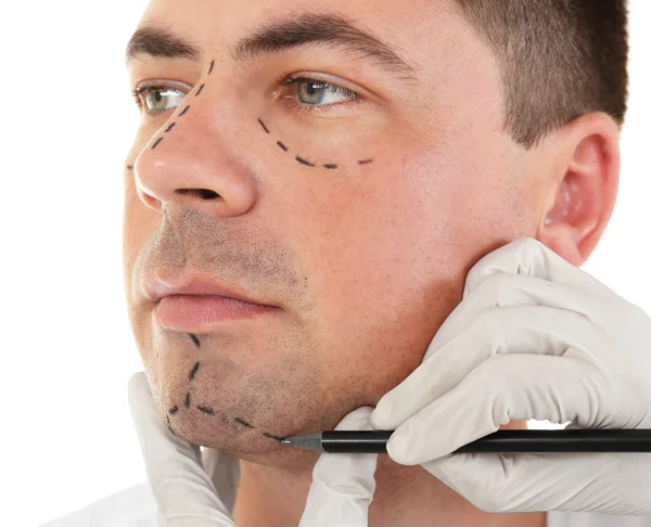 Plastik cerrahi kavramı. Erkek yüz işaretleme eldiven el