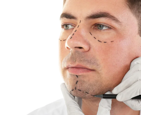 Concepto de cirugía plástica. Mano en guante que marca la cara masculina — Foto de Stock