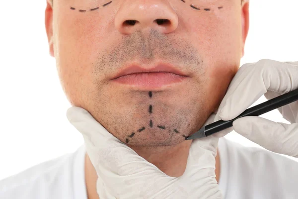 Concepto de cirugía plástica. Manos en guantes marcando la cara masculina — Foto de Stock