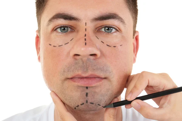 Concepto de cirugía plástica. Manos marcando la cara masculina —  Fotos de Stock