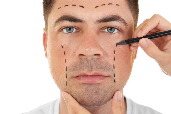 Plastikkirurgi-konceptet. Händer märkning manliga ansikte — Stockfoto