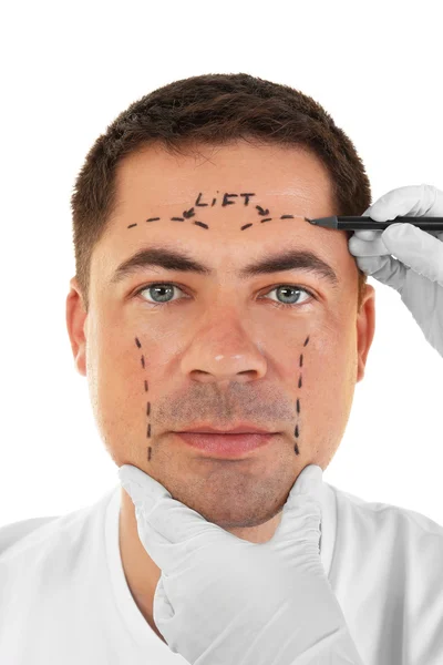 Concepto de cirugía plástica. Manos en guantes marcando la cara masculina — Foto de Stock