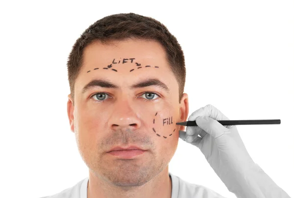 Plastic surgery concept. Hand in glove marking male face — Stock Photo, Image