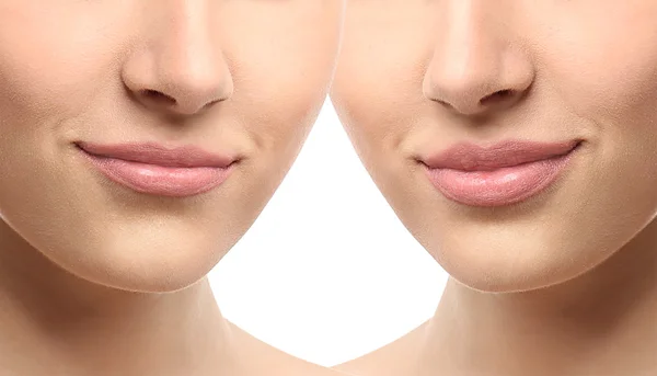 Los labios de la mujer antes y después del procedimiento cosmético — Foto de Stock