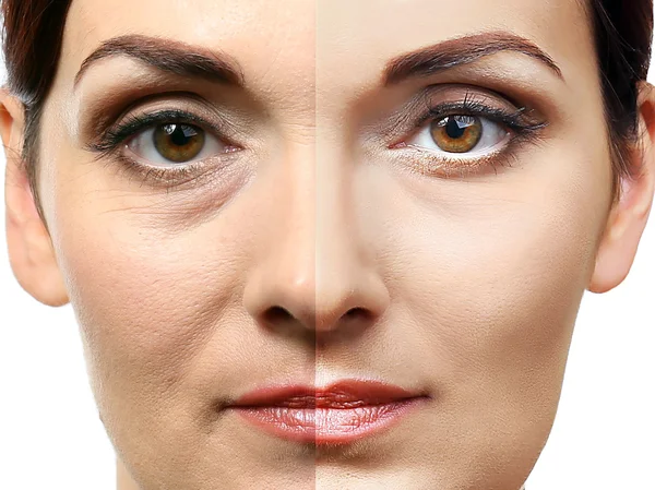 Mujer cara antes y después del procedimiento cosmético. Concepto de cirugía plástica . —  Fotos de Stock