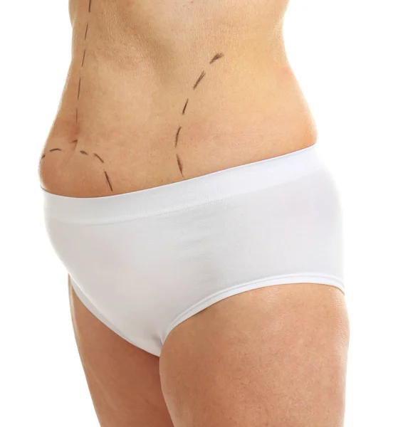 Female body with marks — Stock Photo, Image