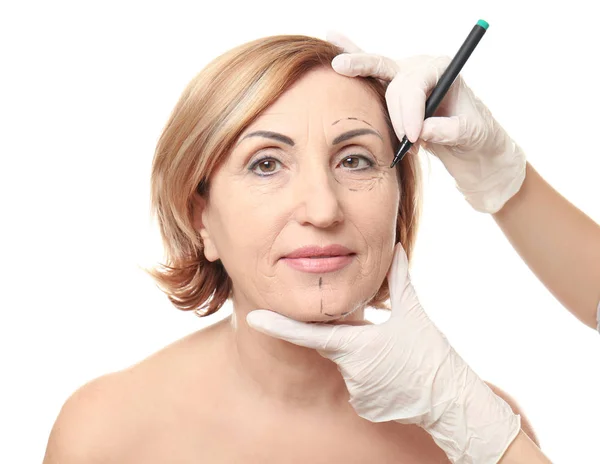 Surgeon hands drawing marks on face — Stock Photo, Image