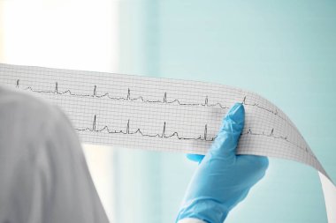 Cardiologist holding cardiogram  clipart