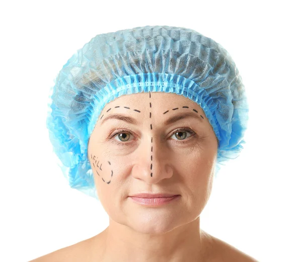 Wanita dengan tanda di wajah untuk operasi plastik — Stok Foto