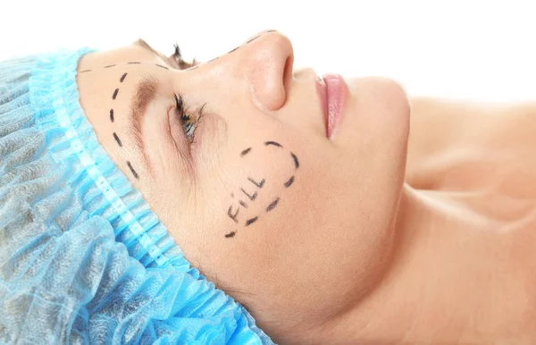 Wanita dengan tanda di wajah untuk operasi plastik — Stok Foto