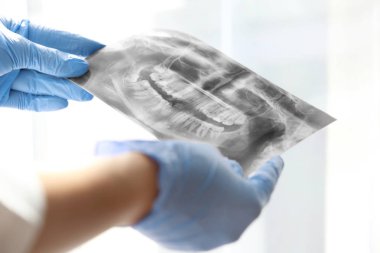 Dişçi grafisi öğretim eldiven