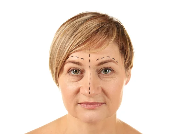 Mujer con marcas en la cara — Foto de Stock