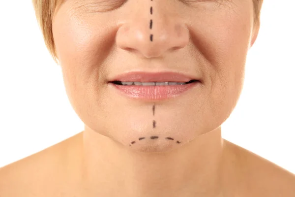 Woman with marks on face — Stock Photo, Image