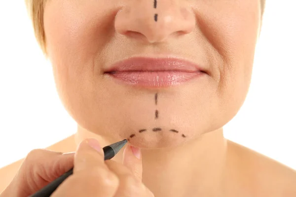 Surgeon hand drawing marks on female face — Stock Photo, Image
