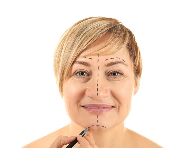 Chirurg zeichnet Markierungen im weiblichen Gesicht — Stockfoto