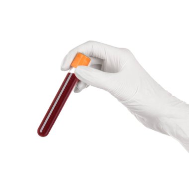 Doktor deney tüpünde kan tutuyor.