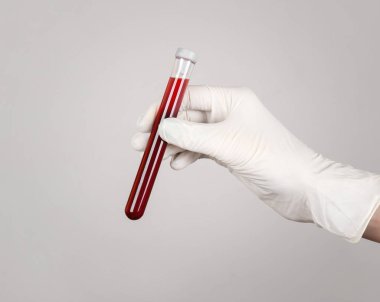 Doktor deney tüpünde kan tutuyor.