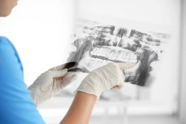 Dentista feminina segurando um raio-X dental — Fotografia de Stock