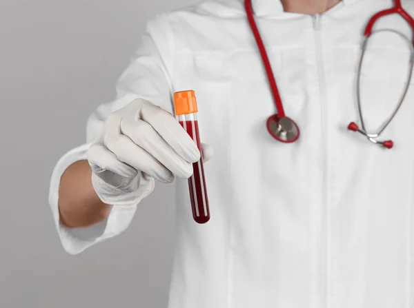 Dokter die bloed vasthoudt in reageerbuis — Stockfoto