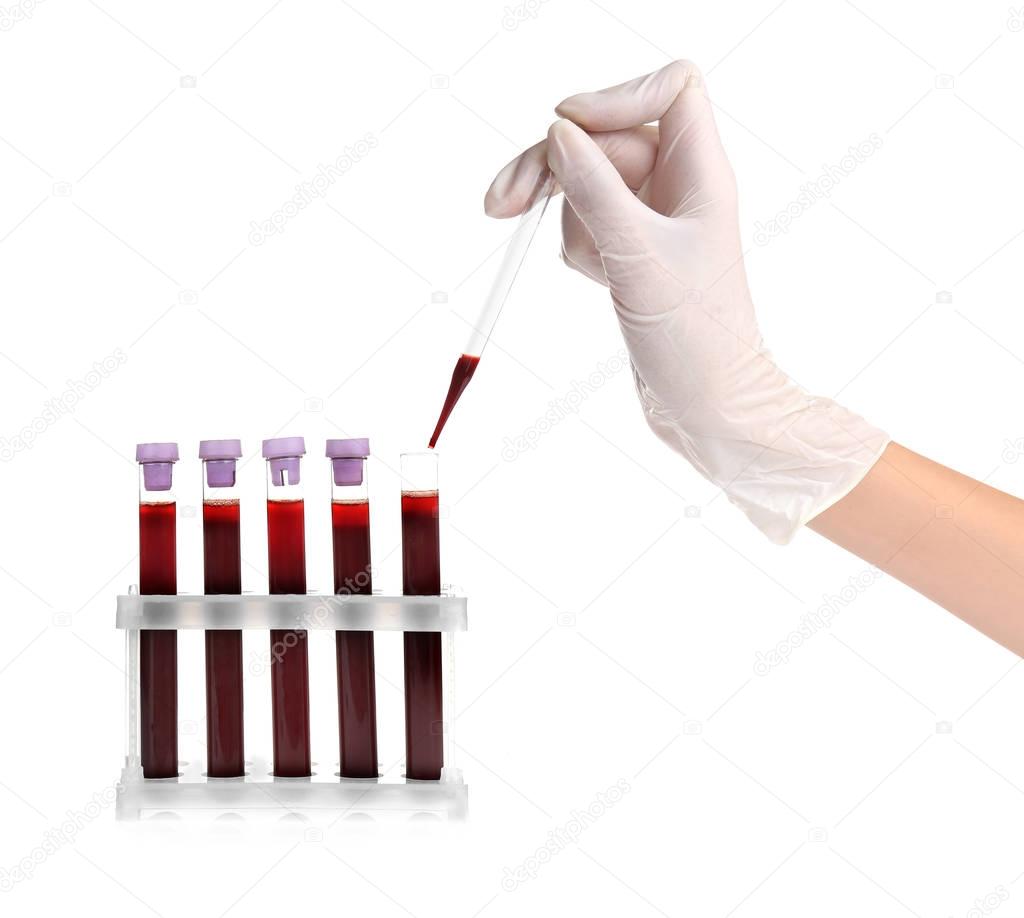Laboratory assistant working with samples of blood 