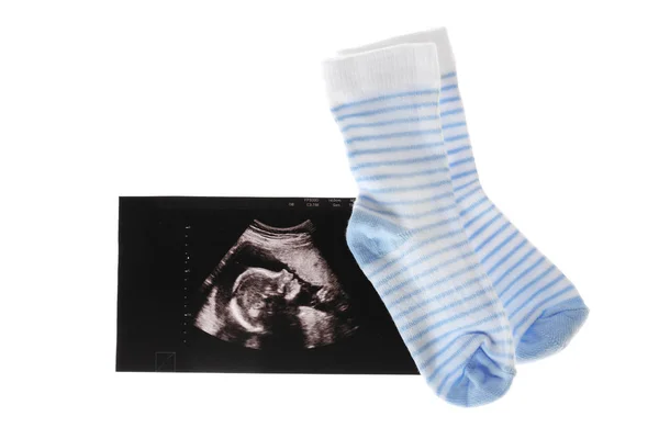Immagine ad ultrasuoni del bambino — Foto Stock