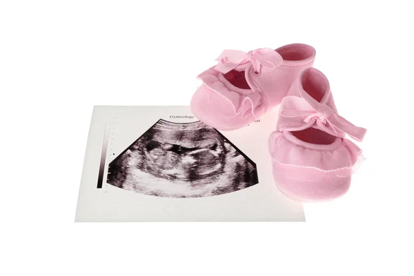 Ultraschallbild des Babys — Stockfoto