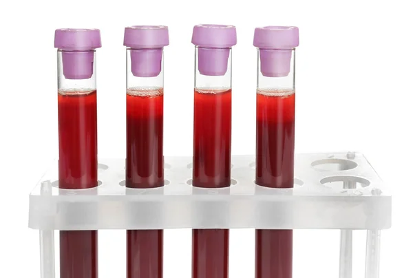 Test tubes with blood — Stock Photo, Image