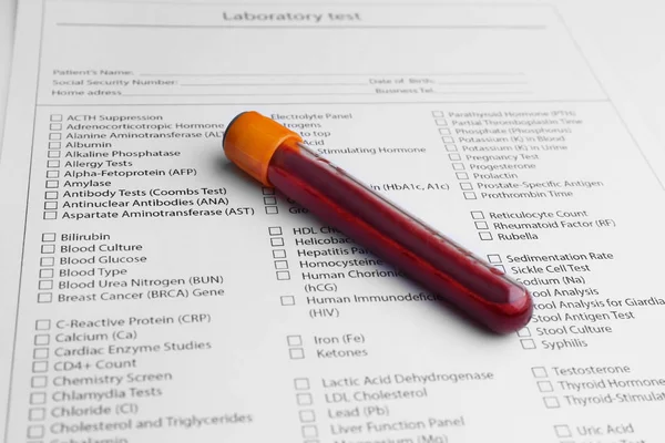 Blood test in glass tube — Stock Photo, Image