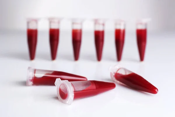 Provette riempite di sangue — Foto Stock