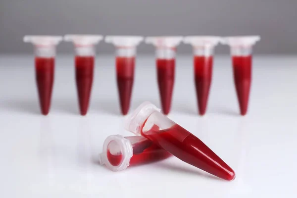 Tubos de ensayo llenos de sangre —  Fotos de Stock