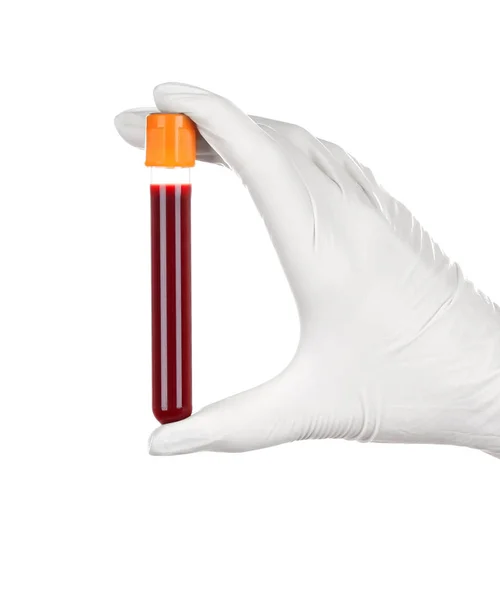 Medico con sangue rosso in mano — Foto Stock