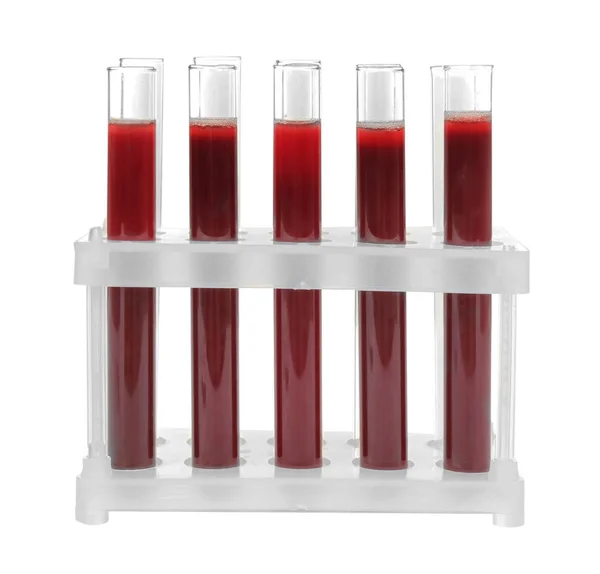 Test tubes with blood Stock Picture