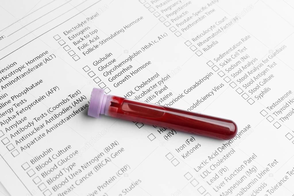  blood test in glass tube