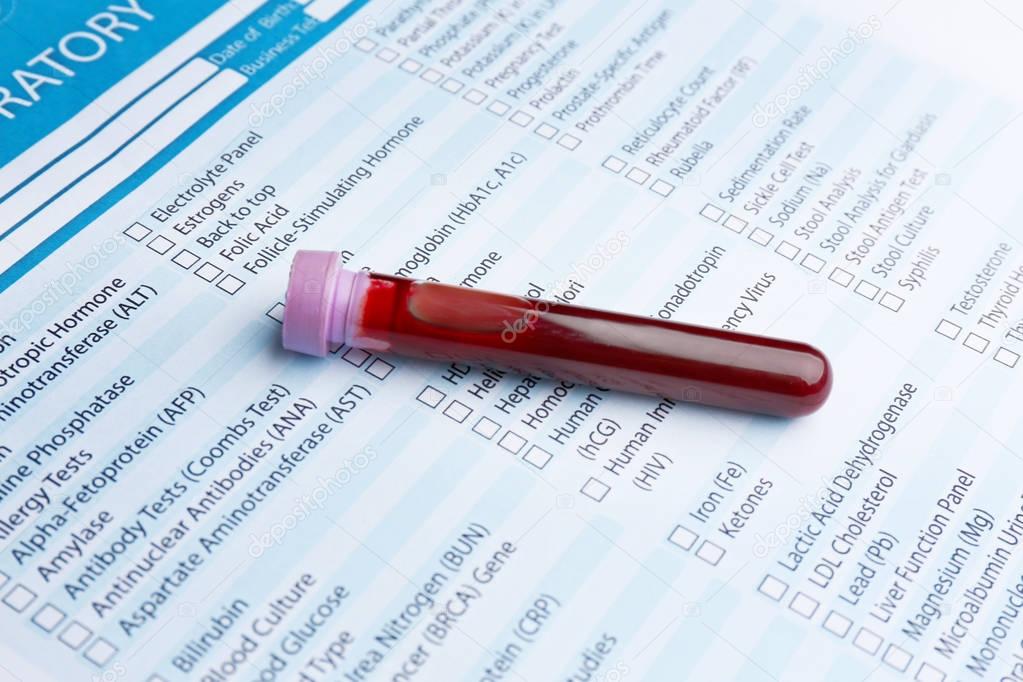  blood test in glass tube
