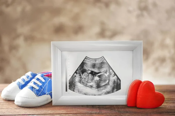 Ultrazvukový obraz dítěte — Stock fotografie