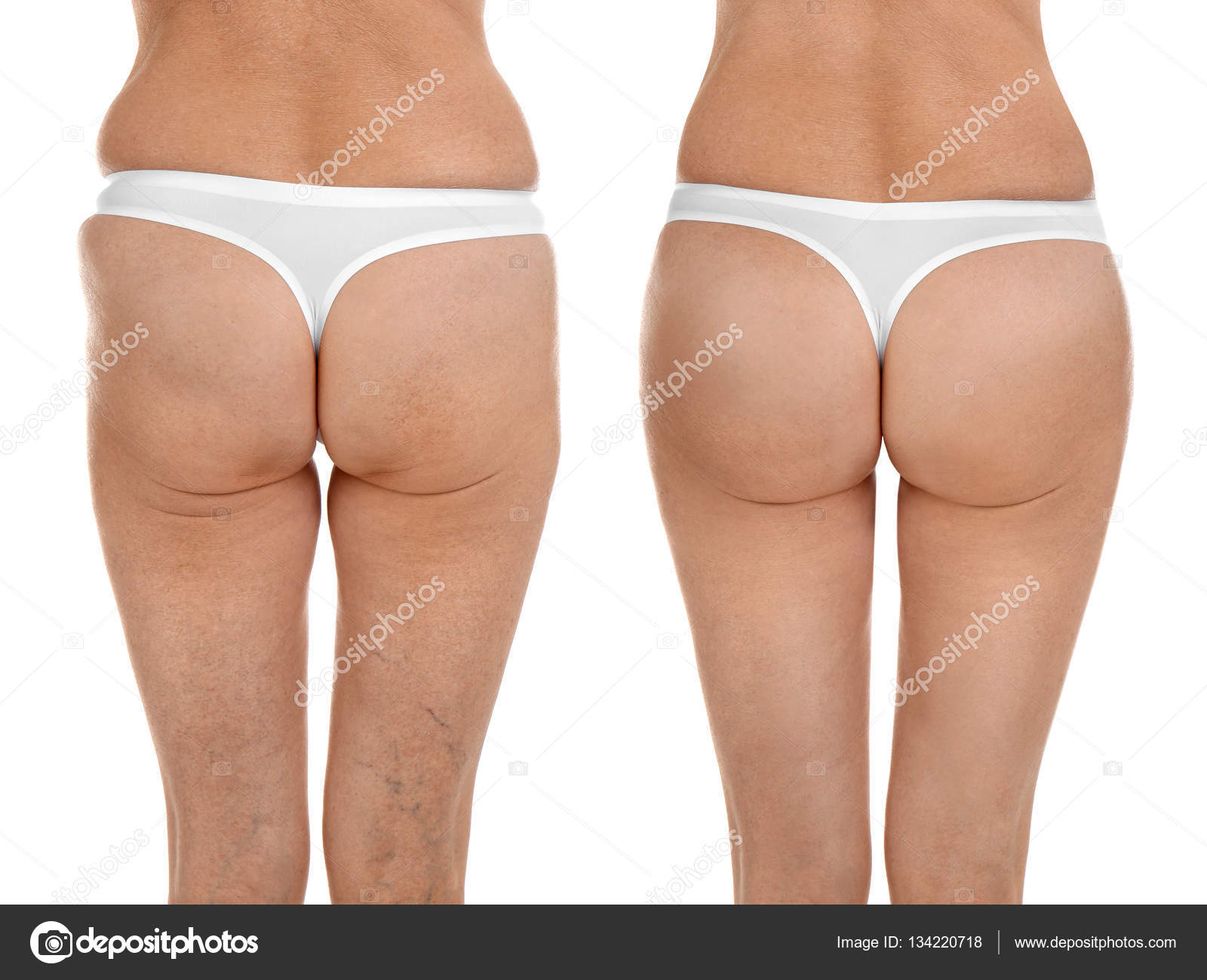 mature female body photos Thumb pain with heat