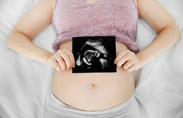 Mani che tengono foto ad ultrasuoni sulla pancia — Foto Stock