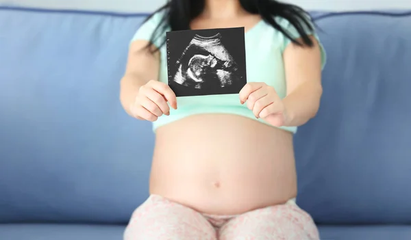 Ultrasound baby scan — Stock Photo, Image
