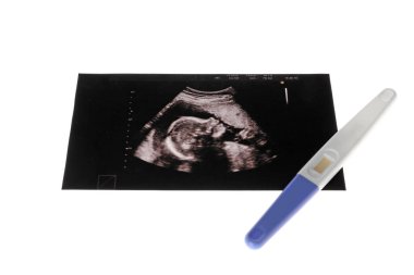 Bebek ultrason resmini