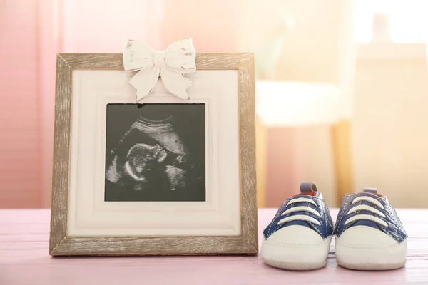 Rahmen mit Ultraschallbild — Stockfoto