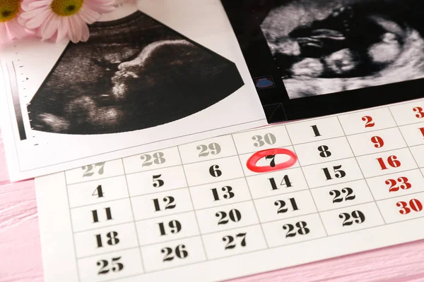 Ultrasound photo and calendar — Stock Photo, Image