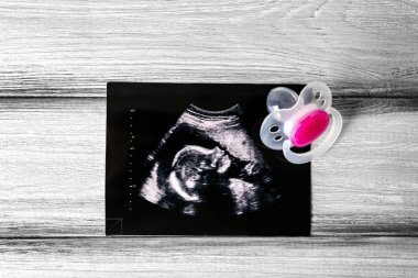 Ultrasound photo and pacifier clipart