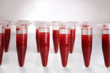 Test tüpleri kanla dolu