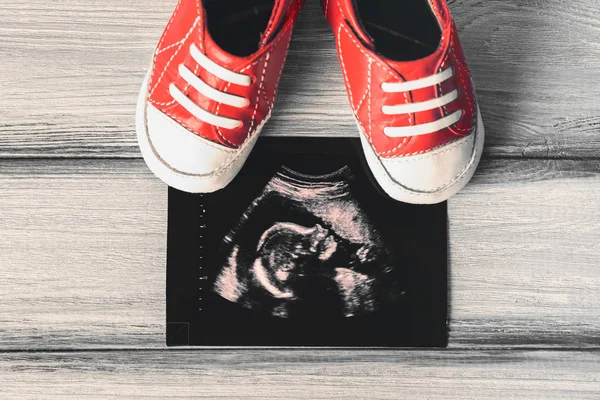 Ultraschall-Baby-Scan — Stockfoto