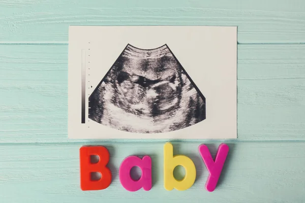 Ecografia baby scan — Foto Stock