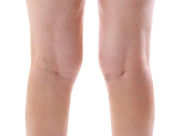 Жіночі ноги на білому — стокове фото