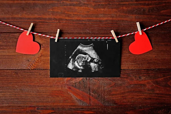 Ultrasound scan bayi pada tali — Stok Foto