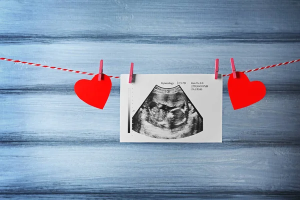 Ultraschall des am Seil hängenden Babys — Stockfoto