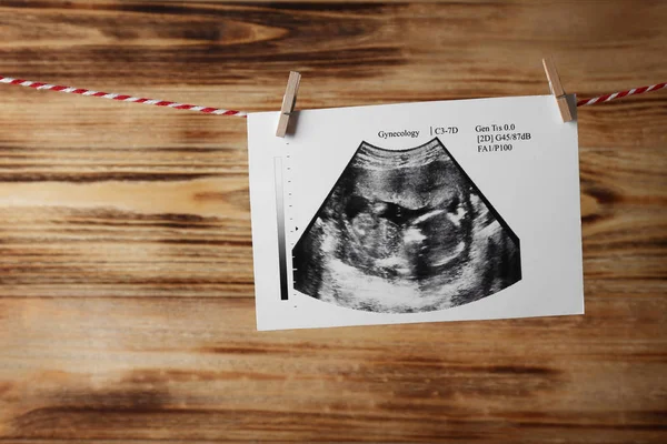 Ultrasound of baby hanging on rope — Stock Photo, Image